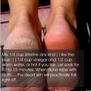 Meet your Posher, Ann